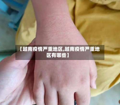 【越南疫情严重地区,越南疫情严重地区有哪些】-第2张图片