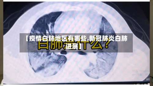 【疫情白肺地区有哪些,新冠肺炎白肺进展】-第1张图片